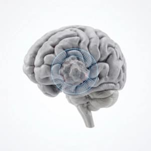 Brain Tumor Surgery