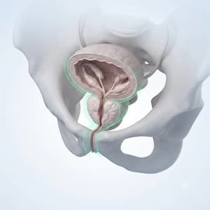 Prostate Surgery