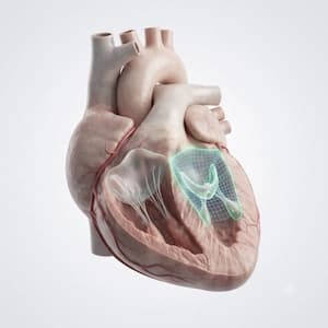 Heart Valve Repair or Replacement Surgery