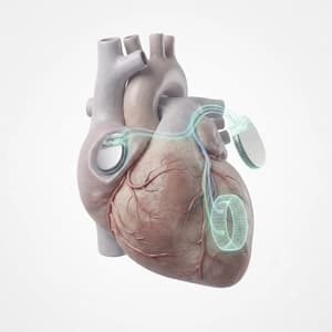 ICD, CRT-D, VAD (Advanced Cardiac Devices)